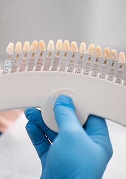 Dentist showing patient porcelain veneers shades