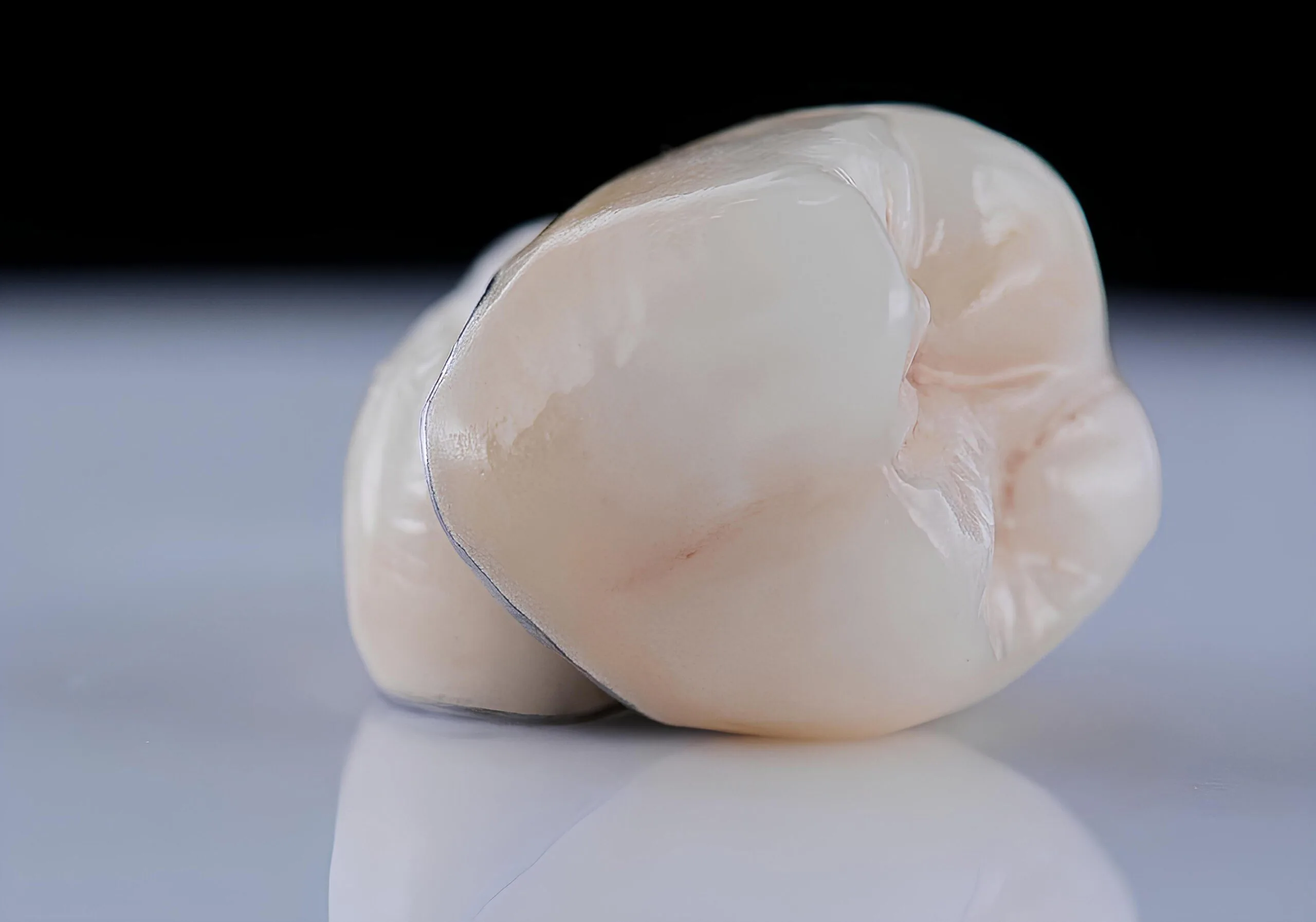 close up of a dental crown from Ritchie Dental Group