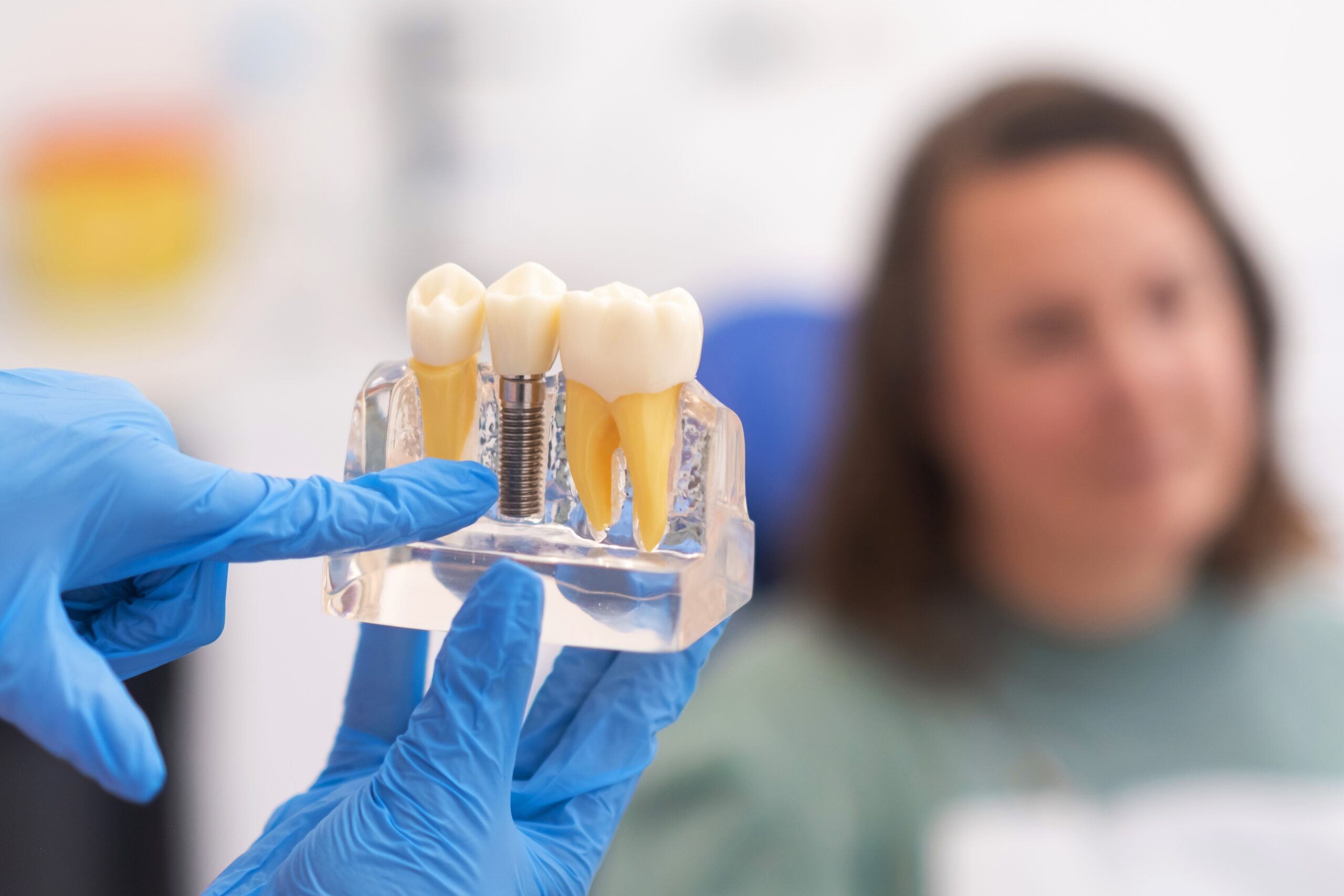 dentist in blue gloves showing a female patient a implant model